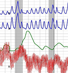 Sierra polygraph test